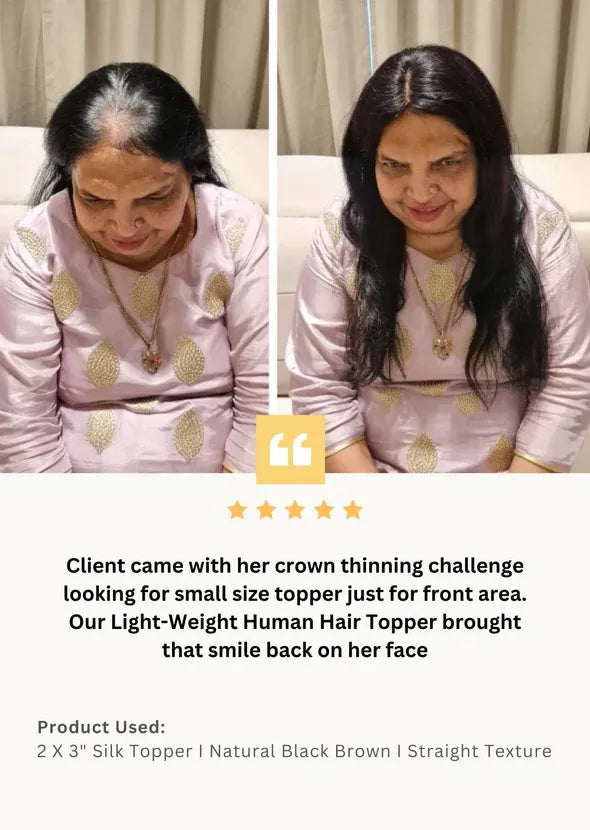 Mini Scalp Topper  2x3 Silk Base Hair Topper